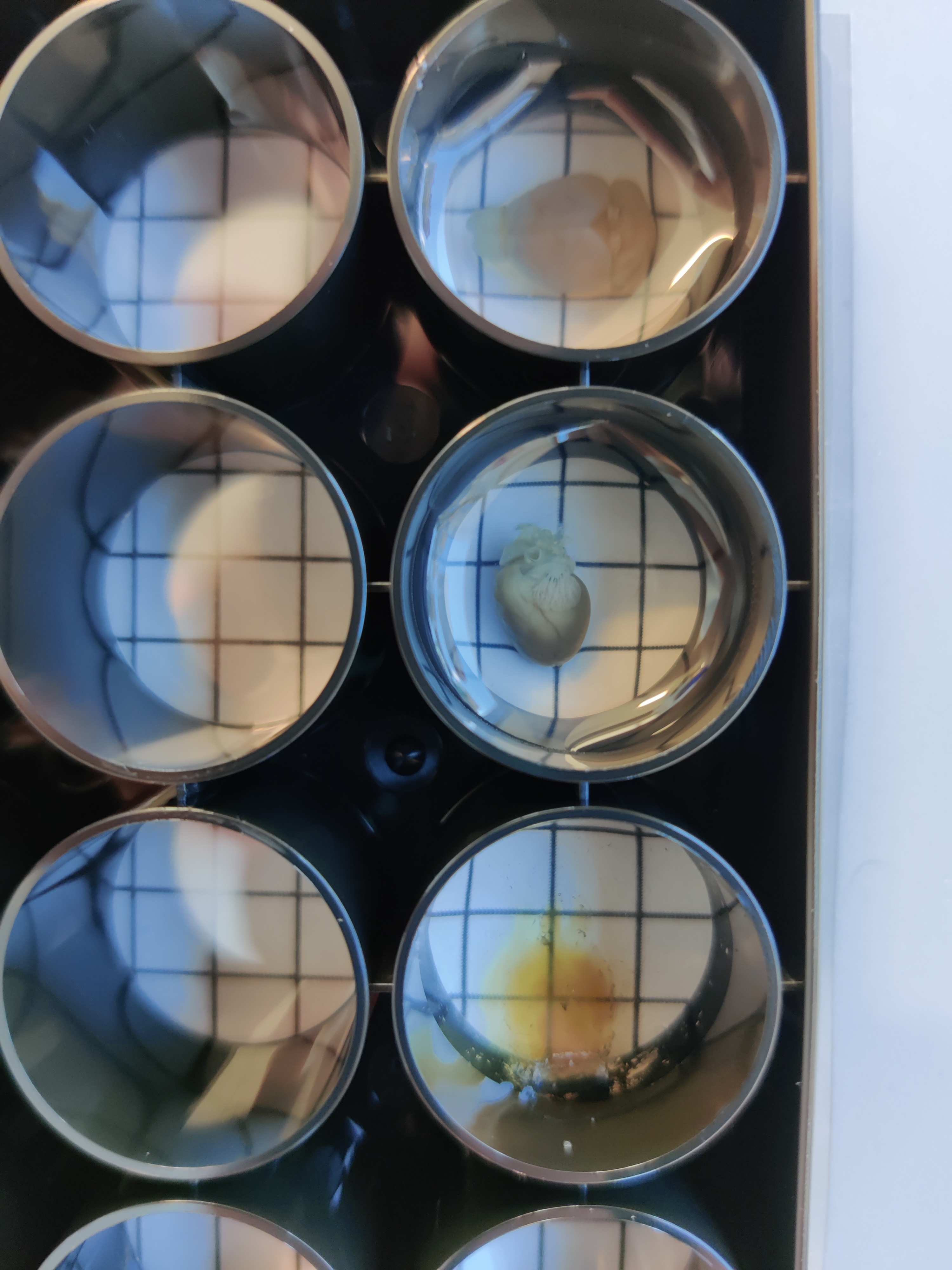 CLARITY-cleared brain tissue