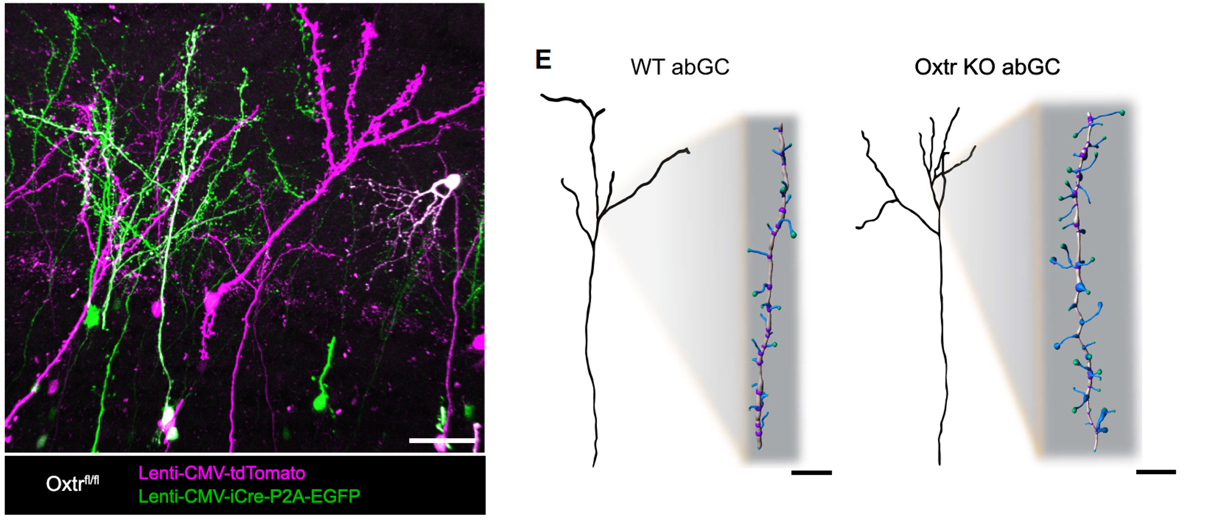 Cell morphology quantification