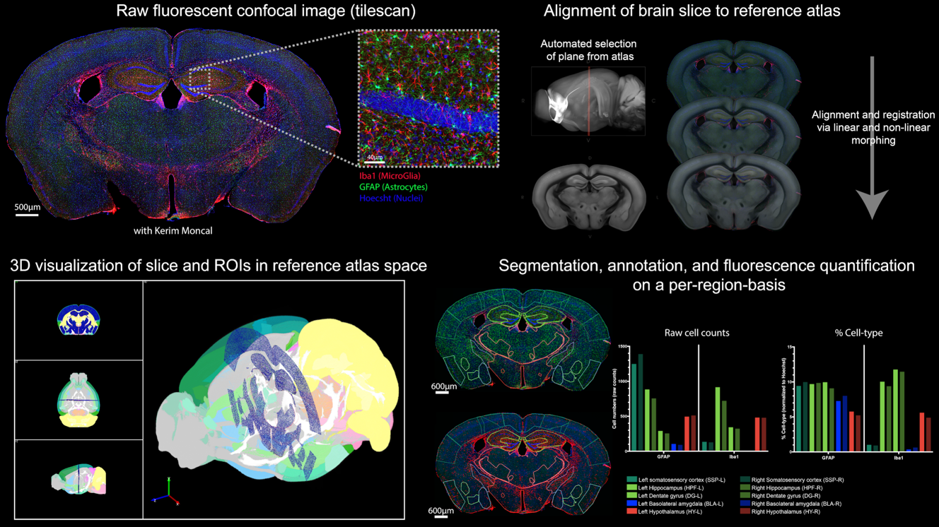Brain slice alignment
