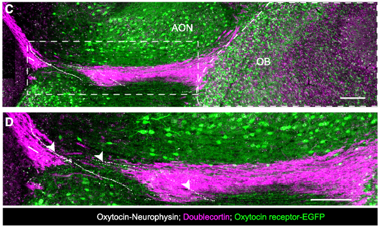 Fiber quantification